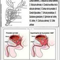 Anatomie de la prostate et la prostatite 1