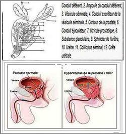 Anatomie de la prostate et la prostatite 1