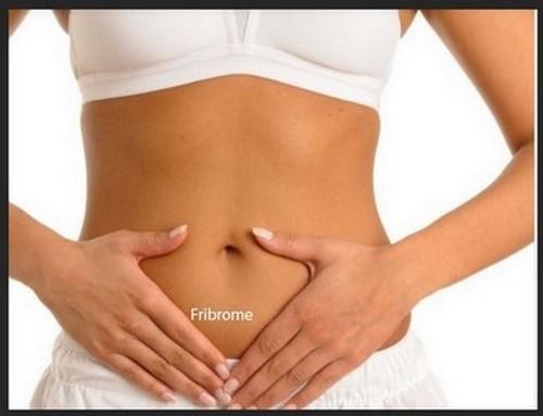 Les fibromes : plante pour finir avec les fibromes