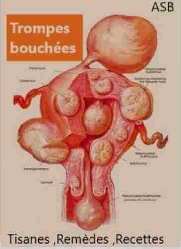 Fibromes