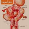 Fibromes