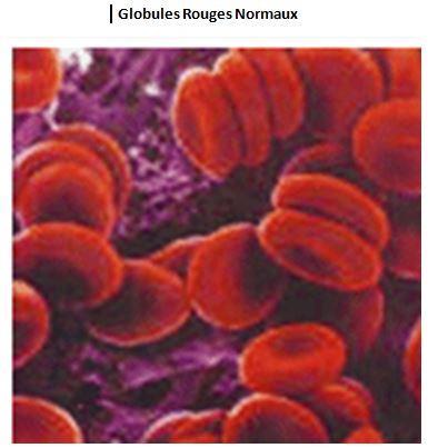 Globules rouges normaux 1