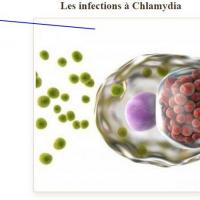 Infection a chlamydia