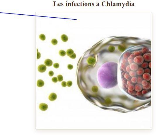 Infection a chlamydia