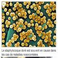 Staphylocoque dore 3