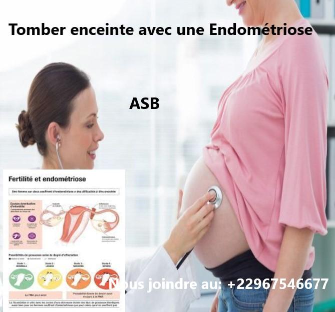 Tomber enceinte avec une Endométriose