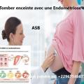 Tomber enceinte avec une endometriose