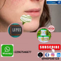 Traitement naturel contre le lupus au congo 1 