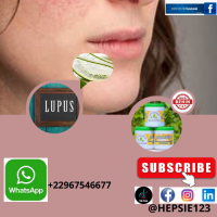 Traitement naturel contre le lupus au congo 1 