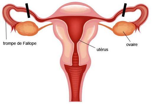 Infertilité Féminine Rétrécir Les Trompes De Fallope Traitement Naturel