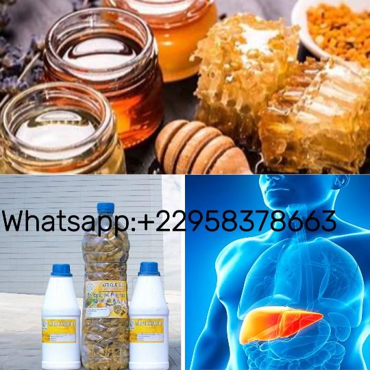 Natural solution to cure hepatitis b