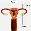Uterus femme
