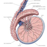 Varicocele t